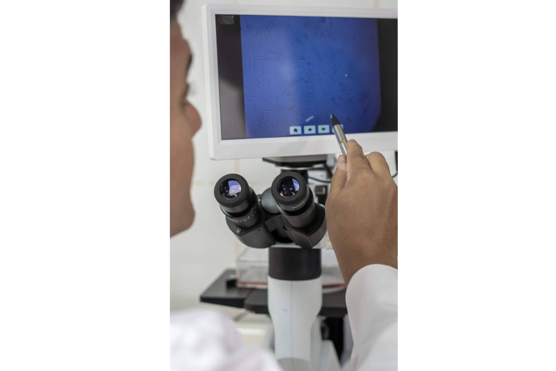 ONCOVIX; Nuevos avances en inmunoterapia DEX personalizada para cáncer